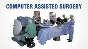 Computer-assisted surgery Market Research Reports 2019-2025 by Blue Belt Technologies Ltd., Think Surgical, Hansen Medical, MAKO Surgical, Renishaw, Stanmore.